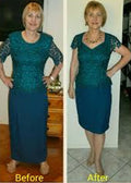 Woman in dress with before and after photos after alteration
