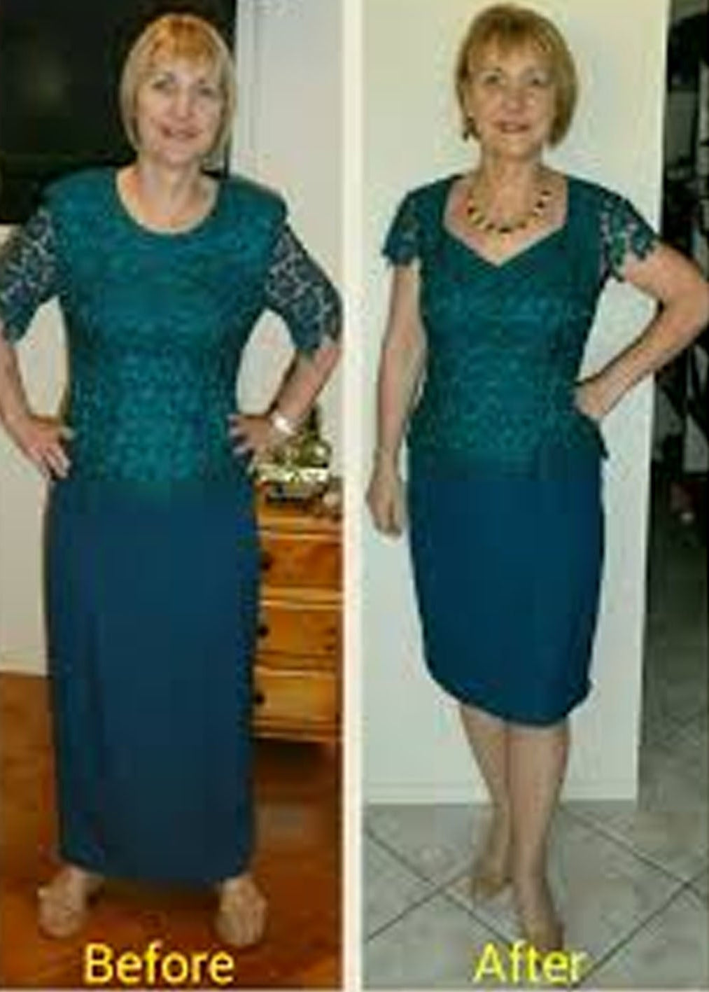 Woman in dress with before and after photos after alteration